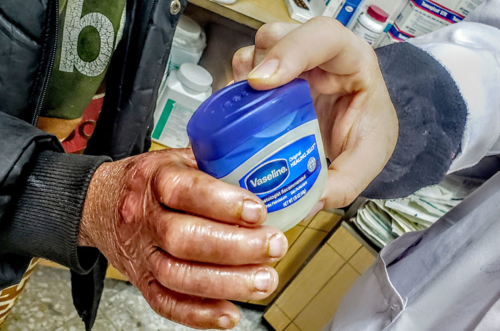 Rafik's inflamed hand holds a container of petroleum jelly.